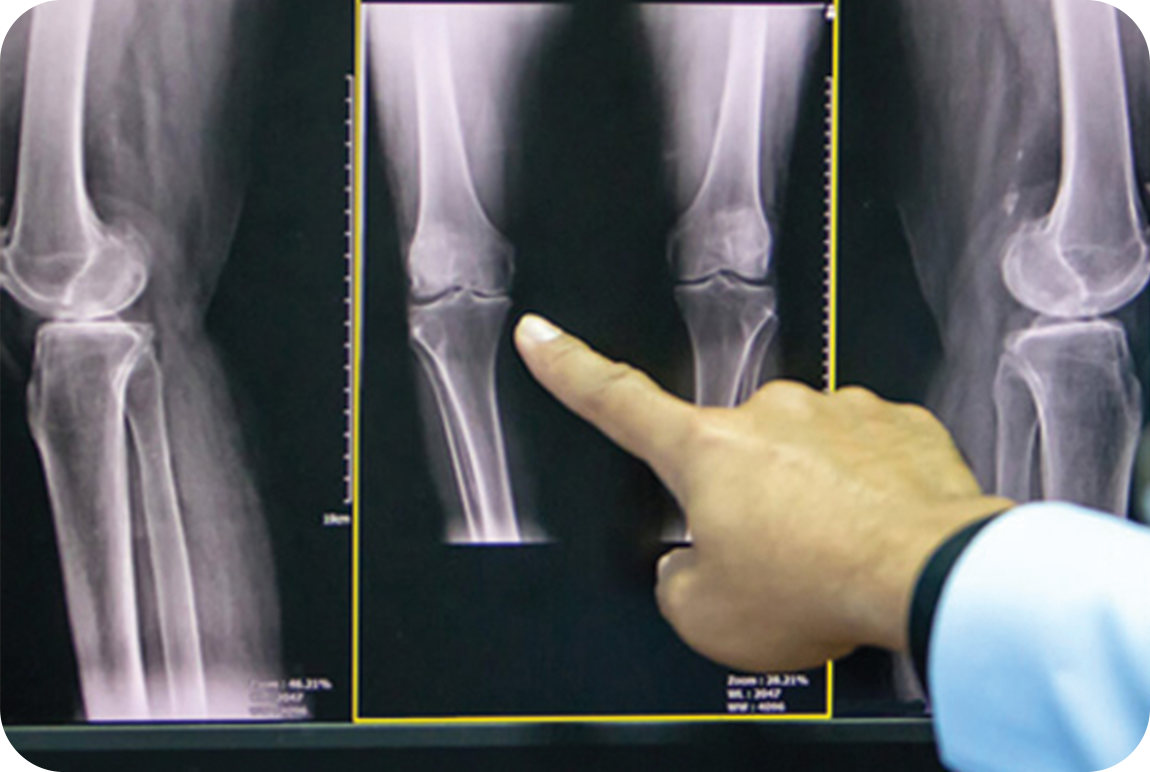 symptoms and diagnosis